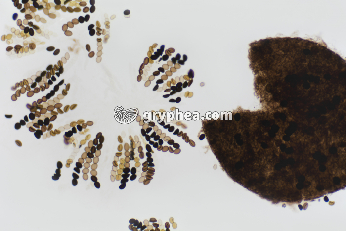 Sordaria asques hybrides x40 - gryphea.com